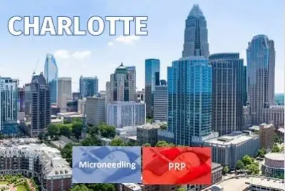 LIVE Cosmetic PRP Facelift and Facial Training with Microneedling & Exosomes Hands-On  Saturday July 26 2025 1pm Charlotte (12 credits) 🔴SOLD OUT🔴