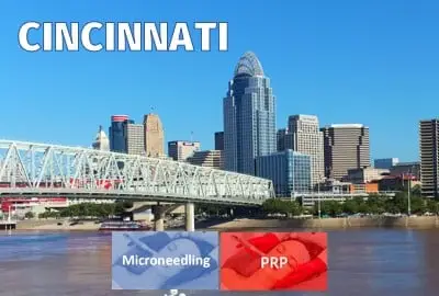 Regenerative Aesthetics™ (Microneedling, Exosomes, PRP Training) FAST TRACK® Hands-On Certification Saturday September 12, 2026  1:00pm Cincinnati (12 Hours) 🟢2+ SEATS LEFT🟢